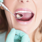 放置は危険！痛みのない虫歯のリスクと進行した虫歯の治療について